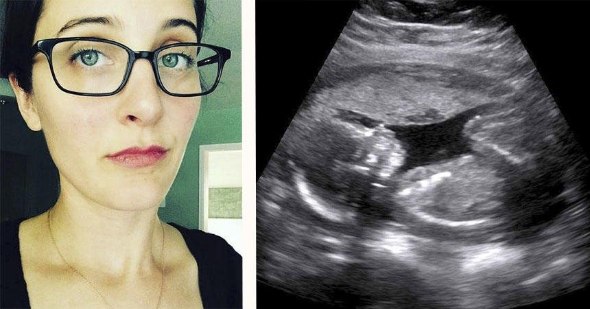 ¿Cuándo vas a tener hijos? Esta mujer dio la mejor respuesta a la dichosa pregunta